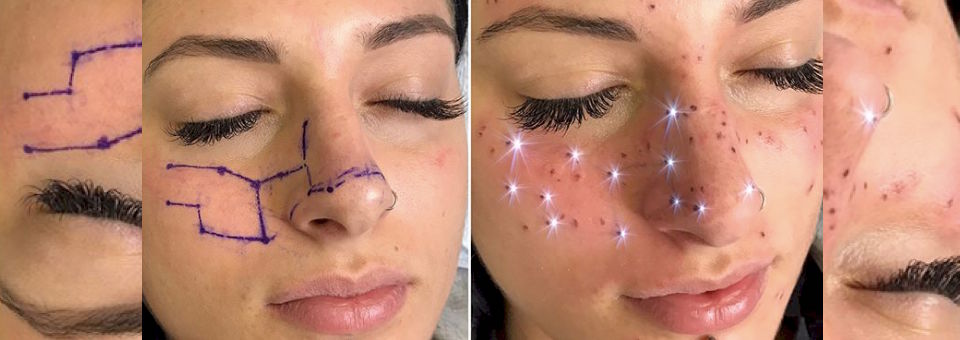 astrofrecks, cosmo, cosmetic tattoos, freckles, astrology freckles, cosmic freckles, freckles